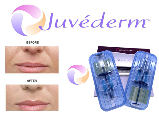 Το δερμικό υλικό πληρώσεως Ultra3 Ultra4 Voluma Juvederm για τη ρυτίδα προσώπου αφαιρεί