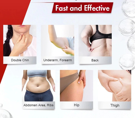 Lipolysis εγχύσεων απώλειας βάρους λύση για την παχιά διάλυση