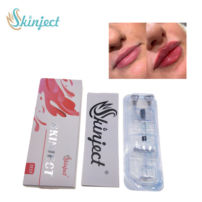 Βαθιά Hyaluronic όξινα δερμικά 2ml χειλικά υλικά πληρώσεως Skinject εκχύσιμα