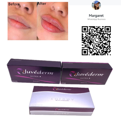 Juvederm δερμική υλικών πληρώσεως 2x1ml συρίγγων χειλική έγχυση πηκτωμάτων βελόνων συνδεμένη σταυρός