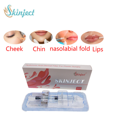 Βαθιά Hyaluronic όξινα δερμικά 2ml χειλικά υλικά πληρώσεως Skinject εκχύσιμα