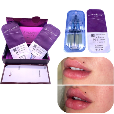 Η χειλική αύξηση Juvederm 2x1ml υλικών πληρώσεως εκταρίου εγχύσεων αφαιρεί τις ρυτίδες