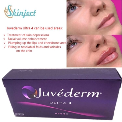 Hyaluronic όξινος δερμικός εκχύσιμος χειλικών υλικών πληρώσεως προσοχής 2x1ml Juvederm προσώπου