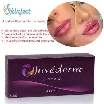 Hyaluronic όξινος δερμικός εκχύσιμος χειλικών υλικών πληρώσεως προσοχής 2x1ml Juvederm προσώπου