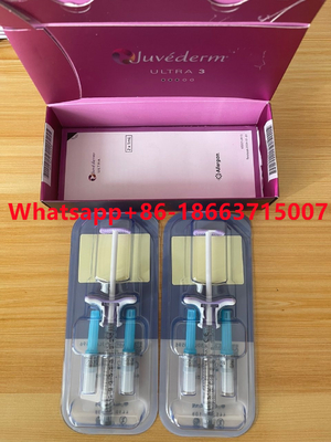Η δερμική έγχυση υλικών πληρώσεως Juvederm Ultra3 Ultra4 για τη χειλική μύτη αφαιρεί τις ρυτίδες