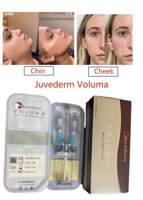 Το Juvederm Voluma διασύνδεσε Hyaluronic όξινο καθαρό εκχύσιμο προσώπου υλικών πληρώσεως μακράς διαρκείας