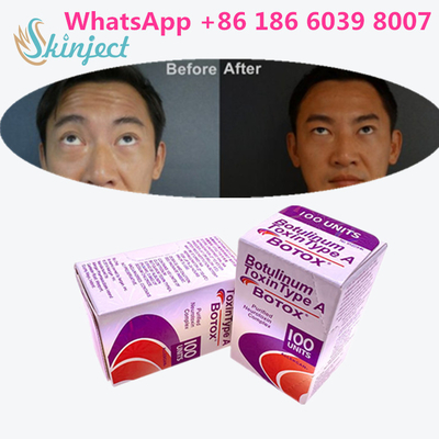 Botulinum τοξίνη Allergan s 1x100iu για τις του προσώπου ρυτίδες