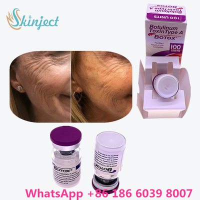 Η Botulinum τοξίνη Allergan  δακτυλογραφεί μια συσκευασία φιαλιδίων/παραθύρων 100units 1