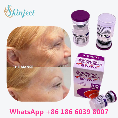 Η Botulinum τοξίνη Allergan  δακτυλογραφεί μια συσκευασία φιαλιδίων/παραθύρων 100units 1