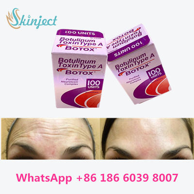 Η Botulinum τοξίνη Allergan  δακτυλογραφεί μια συσκευασία φιαλιδίων/παραθύρων 100units 1