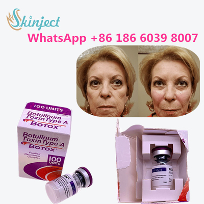 allergan botulinum τύπος προϊόντων γήρανσης τοξινών αντι μια αντι ρυτίδα τοξινών