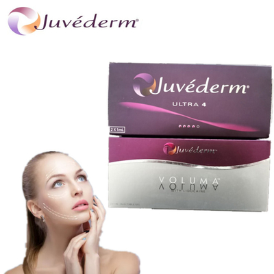 Ο σταυρός Juvederm σύνδεσε το δερμικό υλικό πληρώσεως για τη χειλική διεύρυνση κόκκαλων μάγουλων
