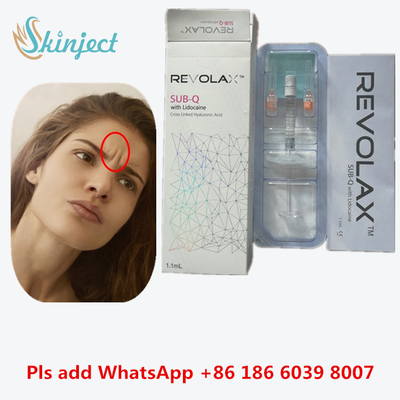 Hyaluronic όξινο δερμικό πρόστιμο Revolax υλικών πληρώσεως για τις του προσώπου ρυτίδες