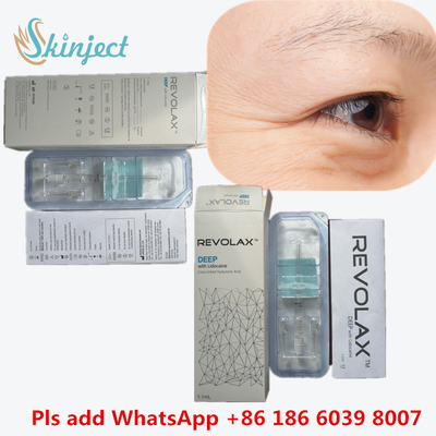 Δερμικό του προσώπου υλικών πληρώσεως Hyaluronic οξύ χειλικών υλικών πληρώσεως Revolax βαθύ με το CE