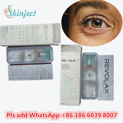 Hyaluronic όξινο Hyaluronic όξινο δερμικό του προσώπου πλαστικό υλικών πληρώσεως KOEAR Revolax μανδρών