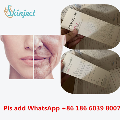 Hyaluronic όξινο Hyaluronic όξινο δερμικό του προσώπου πλαστικό υλικών πληρώσεως KOEAR Revolax μανδρών