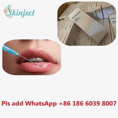 Εκχύσιμο δερμικό υλικό πληρώσεως Revolax 24 mg/$l*ml Hyaluronic όξινη έγχυση εκταρίου
