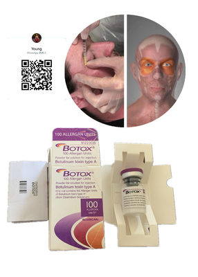 Αντι ρυτίδων Innotoxs s Allergan s δερμική αντι-ηλικία Juviderm αφαίρεσης ρυτίδων υλικών πληρώσεως Botulinum αντι