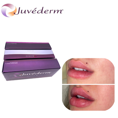 Juvederm Υαλουρονικό οξύ Διεύρυνση χειλιών Δερματικό Filler Αναβάθμιση μύτης Filler Τελειώνει για το πρόσωπο