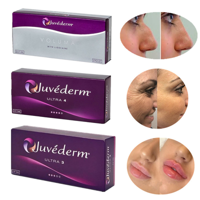 Juvederm 8-12 επαναστατικό εκχύσιμο προϊόν υλικών πληρώσεως μηνών Hyaluronic όξινο δερμικό