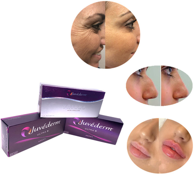 Ανώδυνο διασυνδεμένο Hyaluronic όξινο δερμικό υλικό πληρώσεως για την επεξεργασία ρυτίδων