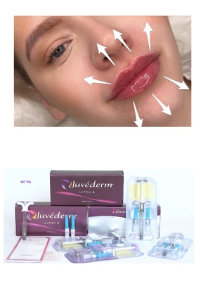 Juvederm' Hyaluronic Acid Dermal Filler Ultra3 Ultra4 Ενέσιμη ποσότητα για γέμιση χειλιών