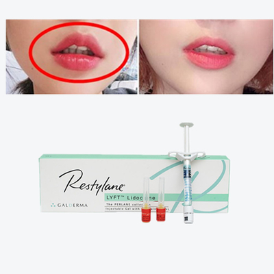 Hyaluronic Acid Dermal Filler HA Filler for Eyes, Mouth and Nose