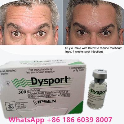 Μπότουλινική τοξίνη Μπότοξ σκόνη Dysport 100iu/1 φιαλίδια για γήρανση του δέρματος
