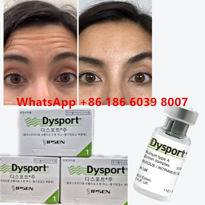 Μπότουλινική τοξίνη Dysport 100u Clostridium Botulinum Type A Για το πρόσωπο Αντιγήρανση ρυτίδες