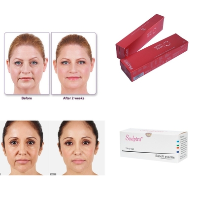 Αντιγήρανση 32mg/Ml Profhilo Συγκέντρωση Υαλουρονικού Οξέος Ενέσιμο Δερματικό Γέμισμα