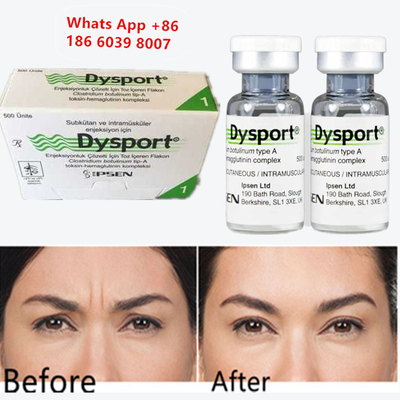 Τοξίνη Βοτουλισμού Α Dysport Ενέσιμο Botox Για Αυξητική Πηγουνιού