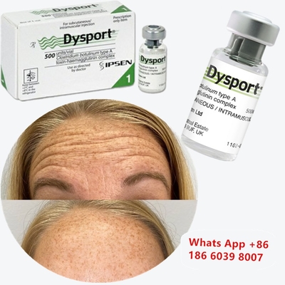 Dysport Βοτουλινική Τοξίνη Τύπου Α για Ρυτίδες της Κοιλάδας των Δακρύων