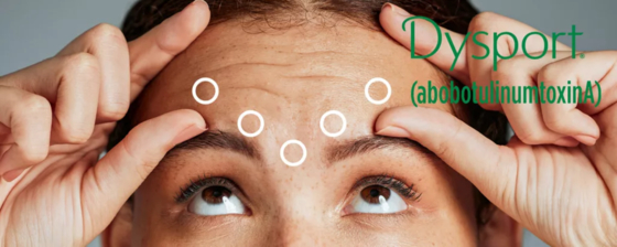 Dysport 500 Για Ένεση abobotulinumtoxinA Botox 500U
