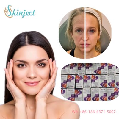 Allergan Botox Nobota 100u 200u για αποτελεσματική θεραπεία των ρυτίδων έκφρασης Ενέσεις τοξίνης αλλαντίασης