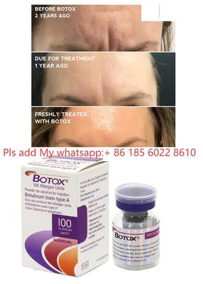 Allergan Botox 100IU Dysport Ένεση Botulax Τοξίνη Βοτουλίνου Αφαίρεση Ρυτίδων