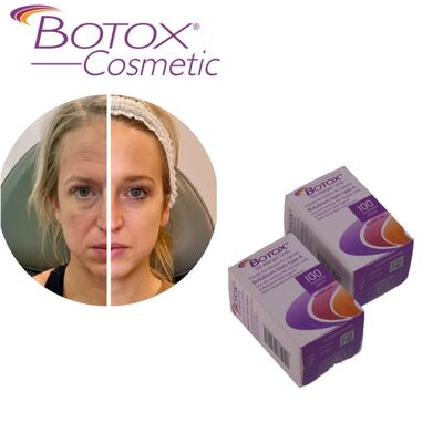 Τοξίνη Βοτουλισμού Botox Allergan Θεραπεία Botox τύπου Α 100IU Λείανση ρυτίδων για το Πρόσωπο