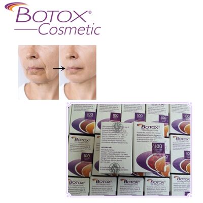 Τοξίνη Βοτουλισμού Botox Allergan Θεραπεία Botox τύπου Α 100IU Λείανση ρυτίδων για το Πρόσωπο