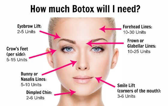 Το αλλεργιογόνο του Beauty Salon Korea Botulinum Toxin για την αντιγήρανση και την αφαίρεση ρυτίδων