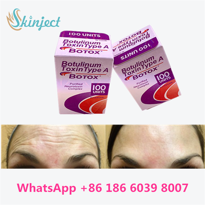 Botulinum Toxin Allergan BOTOX Cosmetic Injection 100 Units for Glabellar lines