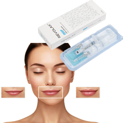 OEM 1.1ml Revolax Fine Deep Sub-Q Lightweight Dermal Filler για λεπτές γραμμές και λεπτή αναζωογόνηση του δέρματος