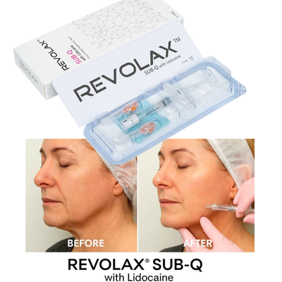 OEM 1.1ml Revolax Fine Deep Sub-Q Lightweight Dermal Filler για λεπτές γραμμές και λεπτή αναζωογόνηση του δέρματος