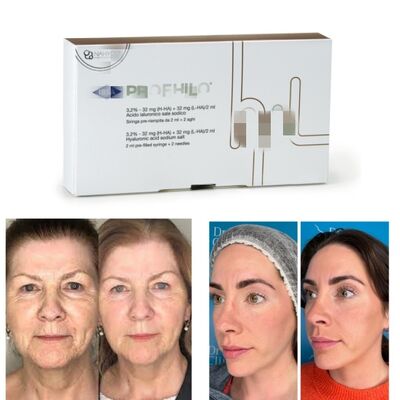 Θεραπεία Profhilo Υαλουρονικό Οξύ Skin Booster & Βιο-Αναδιαμόρφωση