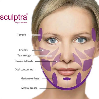 Η σκόνη CE  PLLA για υποκινεί το κολλαγόνο