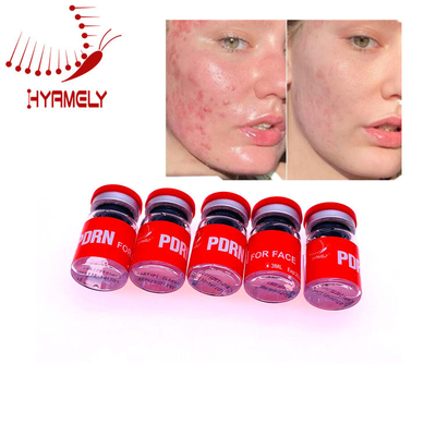 3 συμπληρωματική PDRN εγχύσεων μιλ. Microneedle επισκευή δερμάτων ορών δερμάτων