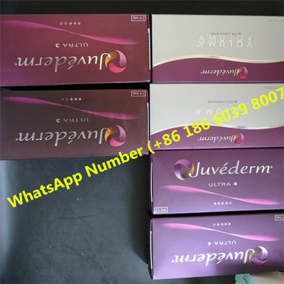Hyaluronic όξινο δερμικό υλικό πληρώσεως Juvederm Ultra3 για τα χείλια