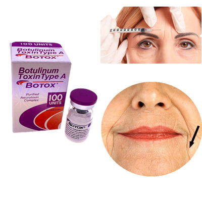 Allergan Botox 100IU Botulinum Toxin Type A για την αφαίρεση ρυτίδων στο πρόσωπο και τα μάτια