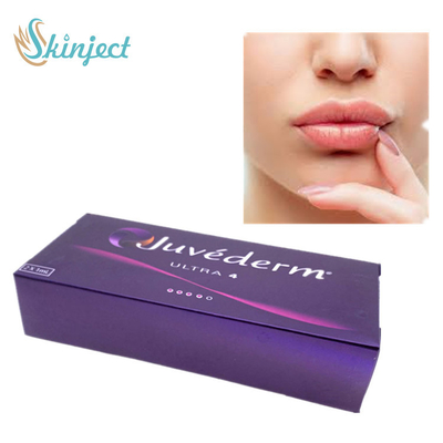 Δερμικό υλικό πληρώσεως εξαιρετικά 4 Juvederm για Hyaluronic όξινο δερμικό υλικό πληρώσεως υλικών πληρώσεως χειλικών δερμάτων το δερμικό