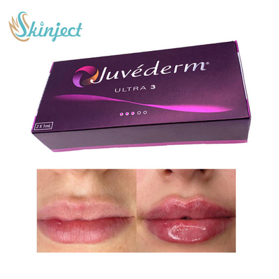 281ML Hyaluronic όξινο χειλικό υλικό πληρώσεως Juvederm Ultra3 δερμικό
