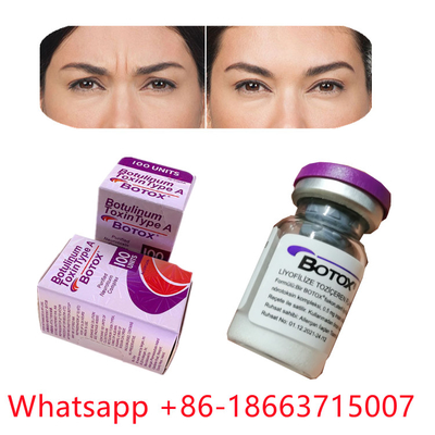 Η Botulinum τοξίνη Allergan δακτυλογραφεί μια μορφή σκονών