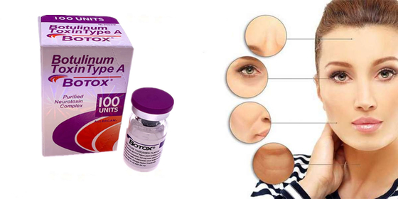 Η Botulinum τοξίνη Allergan δακτυλογραφεί μια μορφή σκονών